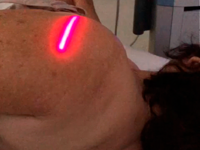 LASER